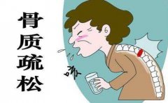 对于骨密度症 我们会有哪些常见的误解