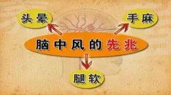 脑中风的前兆早知道 经颅多普勒帮助检查脑血管疾病